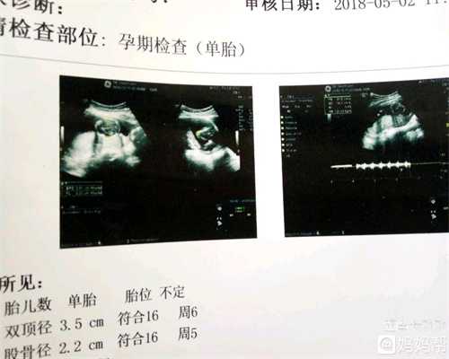 天津代孕中心_孕29周胎儿在哪个位置