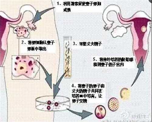 天津代孕方法-天津哪里可以供卵-怀孕21周有血池怎么办